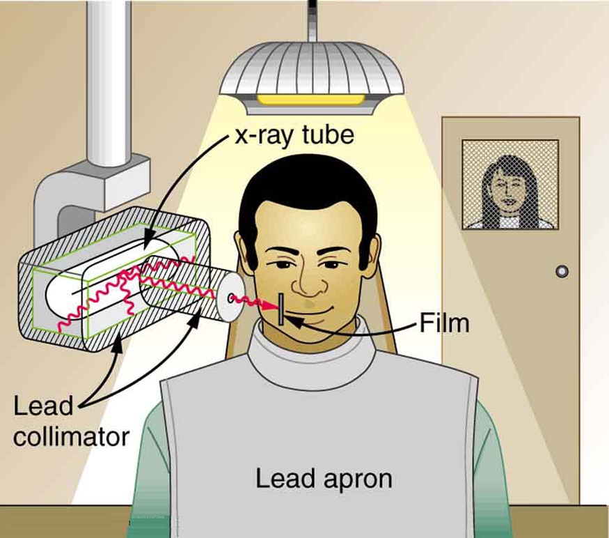 The image shows a dental patient wearing a lead apron sitting in a chair. X-rays emitting from an X-ray tube that is placed on the side of the patient’s jaw are passing through only the affected area of his teeth.